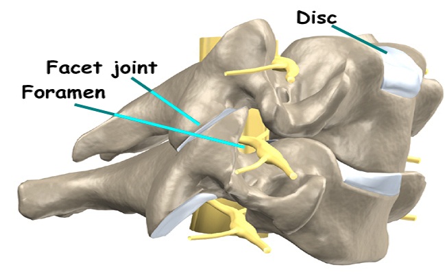 Facet Joint Syndrome Treatment in Los Angeles