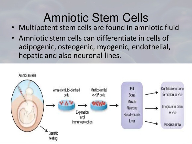 Amniotic Stem Cell Therapy Los Angeles