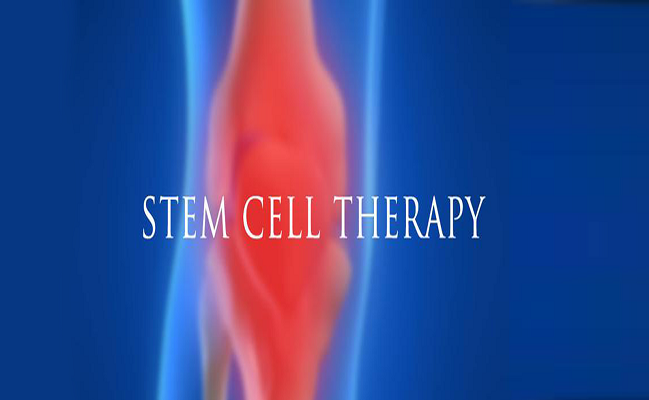 Amniotic Stem Cell Therapy Beverly Hills