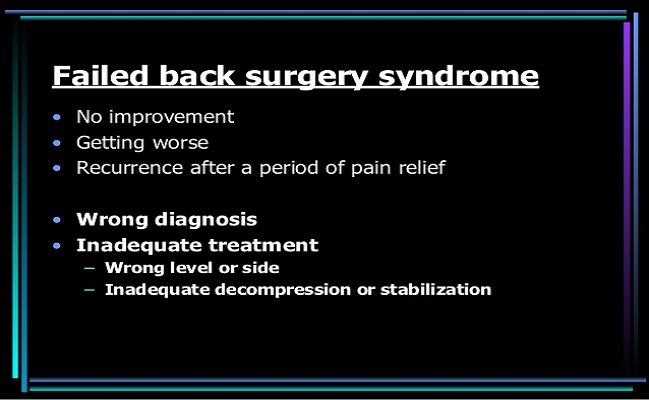 Failed Back Surgery Syndrome Beverly Hills