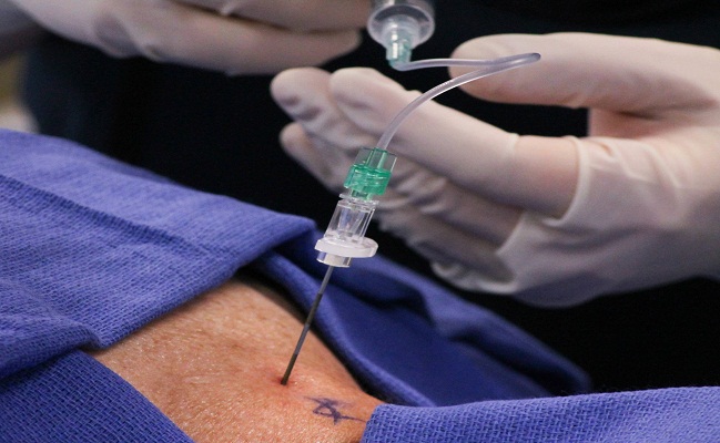 Epidural Steroid Injections in Beverly Hills