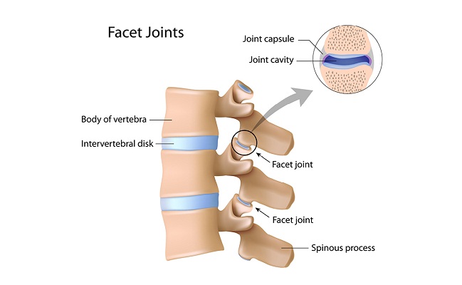 Facet Joint Injections in Los Angeles