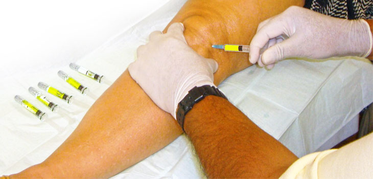 Knee Injections in Los Angeles & Beverly Hills CA