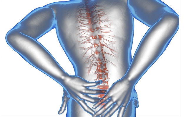 Lumbar Discogram in Beverly Hills