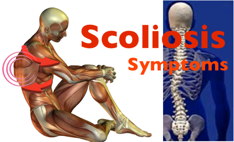 Painful Adult Scoliosis Treatment Los Angeles & Beverly Hills