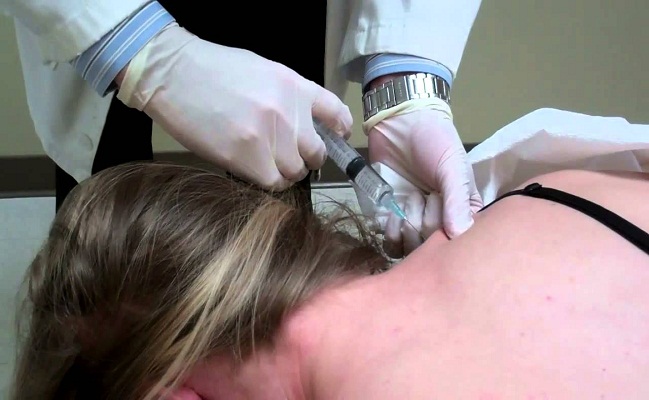 Trigger Point Injection in Beverly Hills