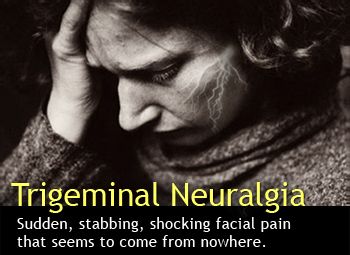 Trigeminal Neuralgia top Pain Clinic in Los Angeles