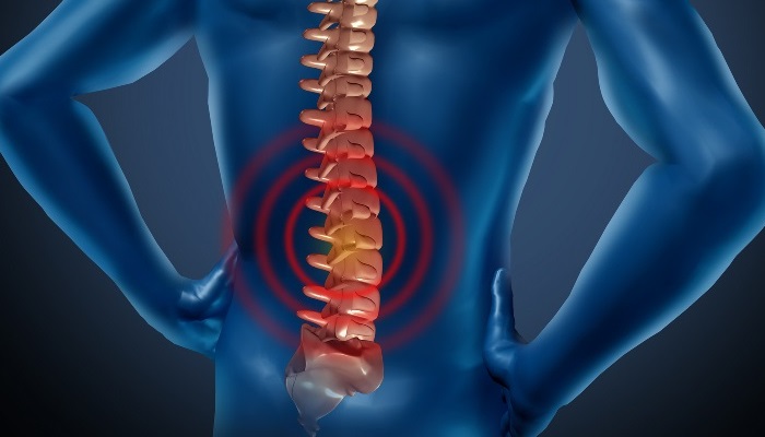 Stem Cell Therapy for Back Pain in Beverly Hills