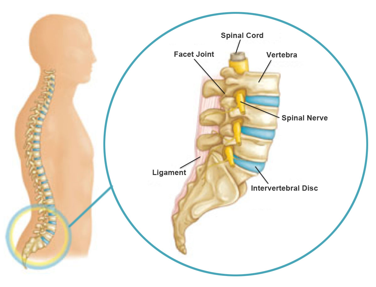Top Spinal Stenosis Treatment in Los Angeles