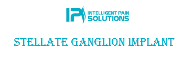 Stellate Ganglion Implant Los Angeles & Beverly Hills CA